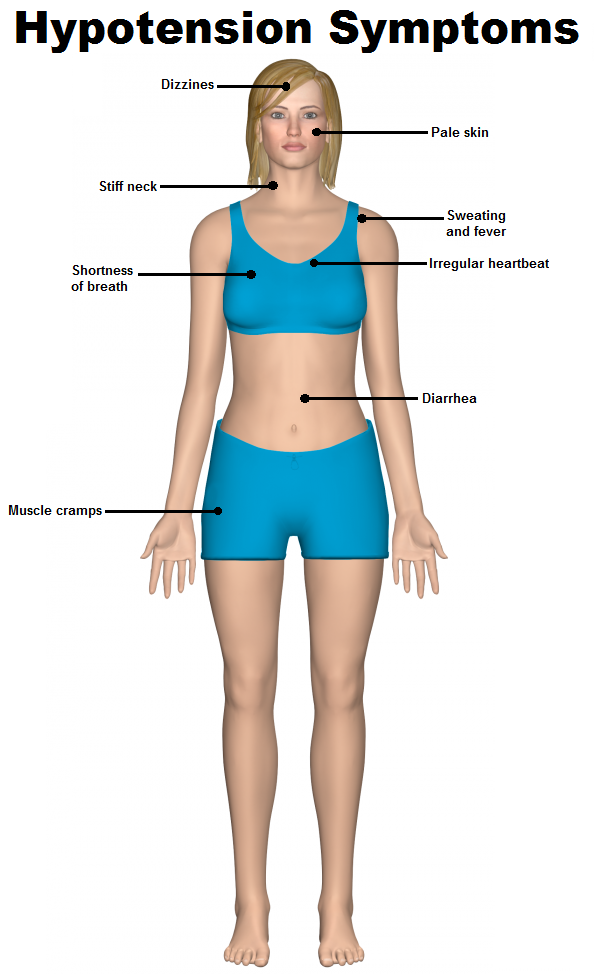 hypotension symptoms