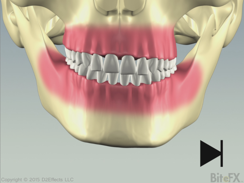 January 2015 BiteFX Updates
