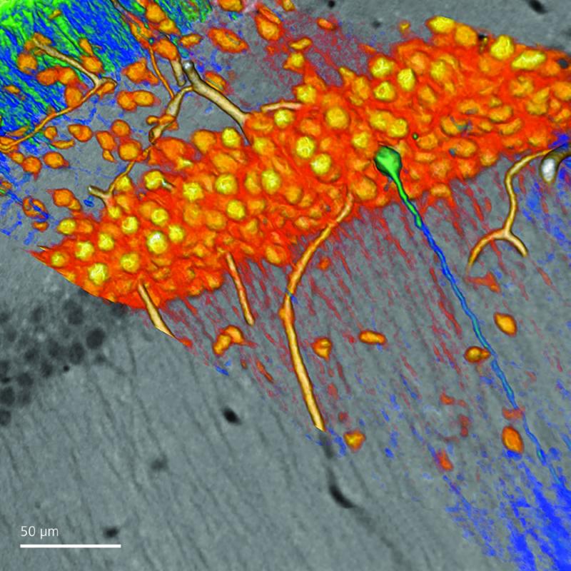 Mammalian brain tissue. Courtesy of the National Center for Microscopy and Imaging Research (NCMIR), University of California, San Diego