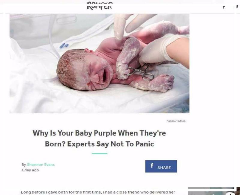 Why is your baby purple when they're born? Experts say not to panic. 