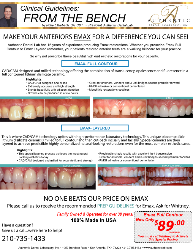 Make Your Anteriors Emax or Emax Layered 👌